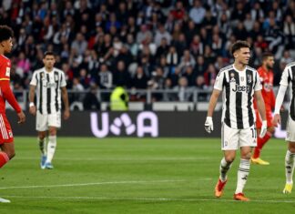 Bayerns Startelf gegen Juventus: Nagelsmann setzt auf 4-2-3-1 mit Musiala als Zehner